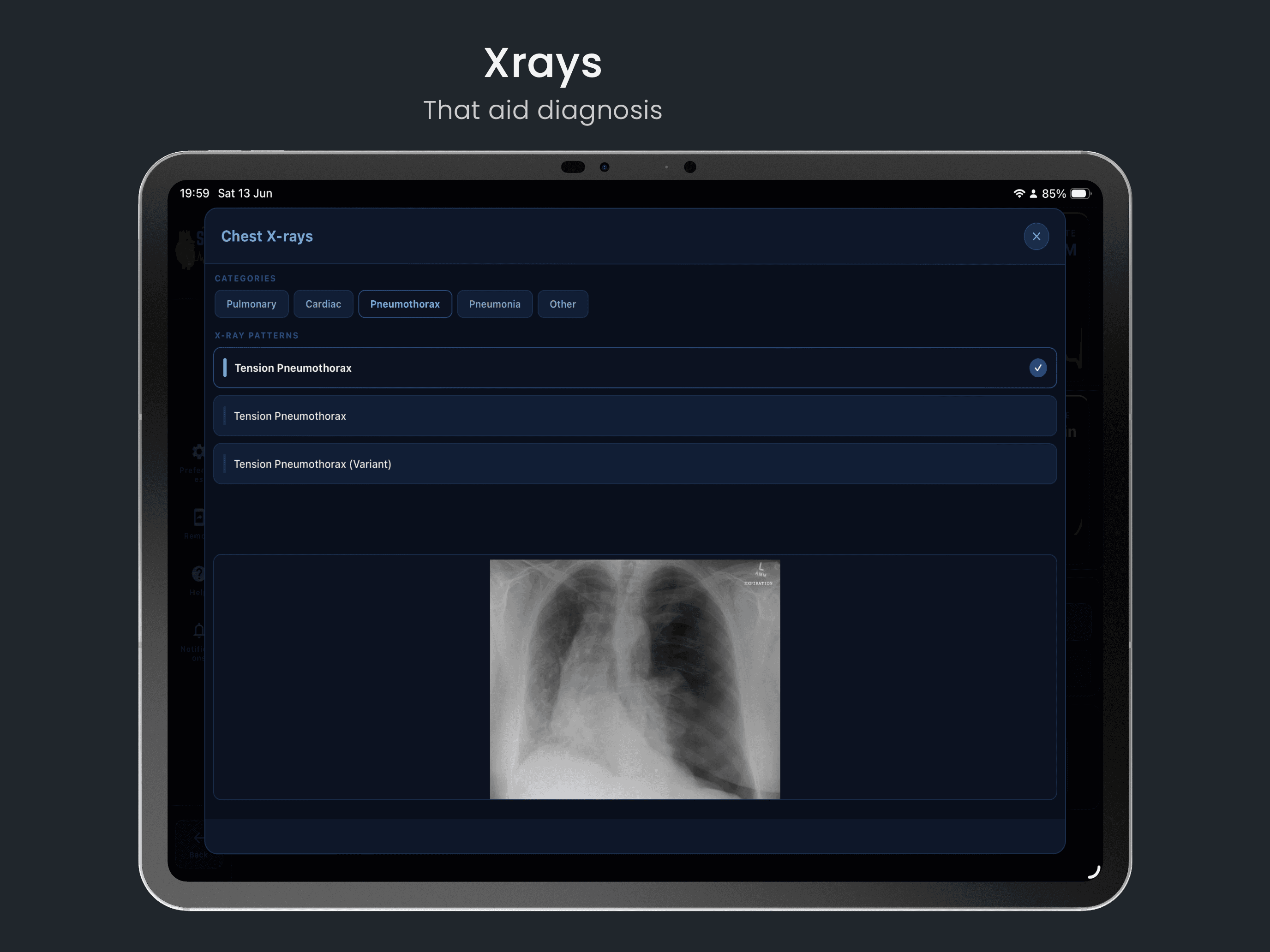 Quiz Hub — ACLS, PALS, ECG, and reversible causes